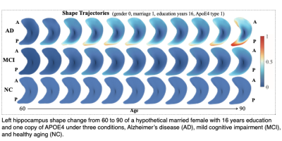 Left hippocampus shape change from 60 to 90 of a hypothetical married female with 16 years education and one copy of APOE4 under three conditions, Alzheimer’s disease (AD), mild cognitive impairment (MCI), and healthy aging (NC).